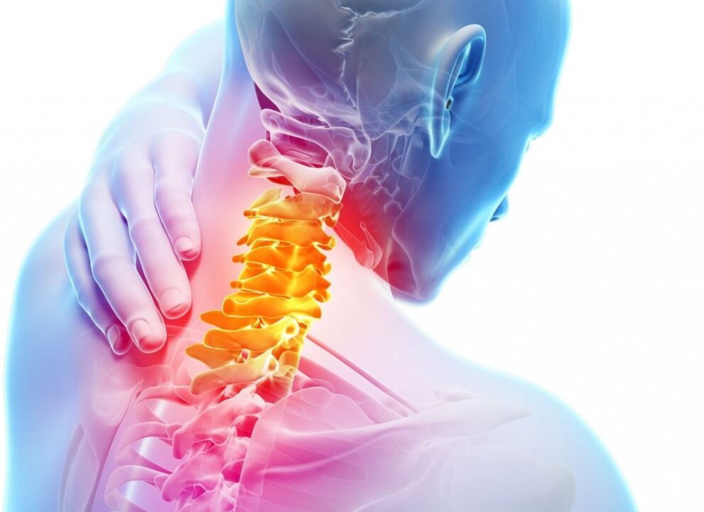 Kaj je osteohondroza materničnega vratu