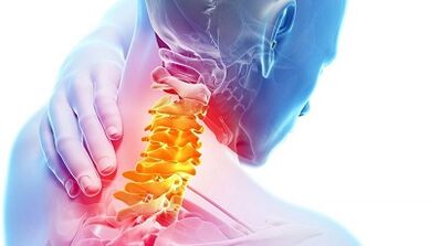 Vzroki za osteohondrozo materničnega vratu