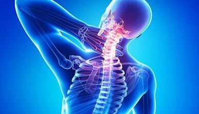 zapleti osteohondroze vratne hrbtenice