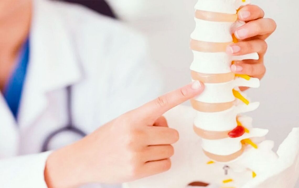 poškodbe hrbtenice zaradi cervikalne osteohondroze