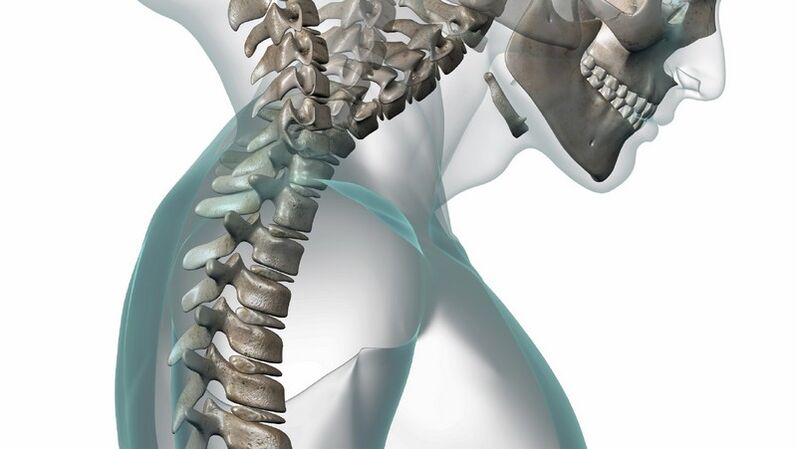 vratne hrbtenice in osteohondroze